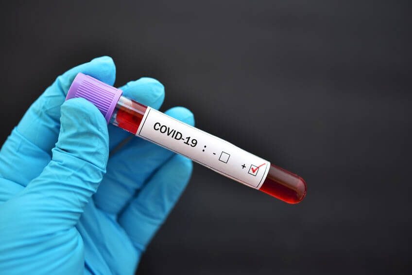 H&L BDC Telah Mengesahkan Seorang Kakitangan Positif COVID-19